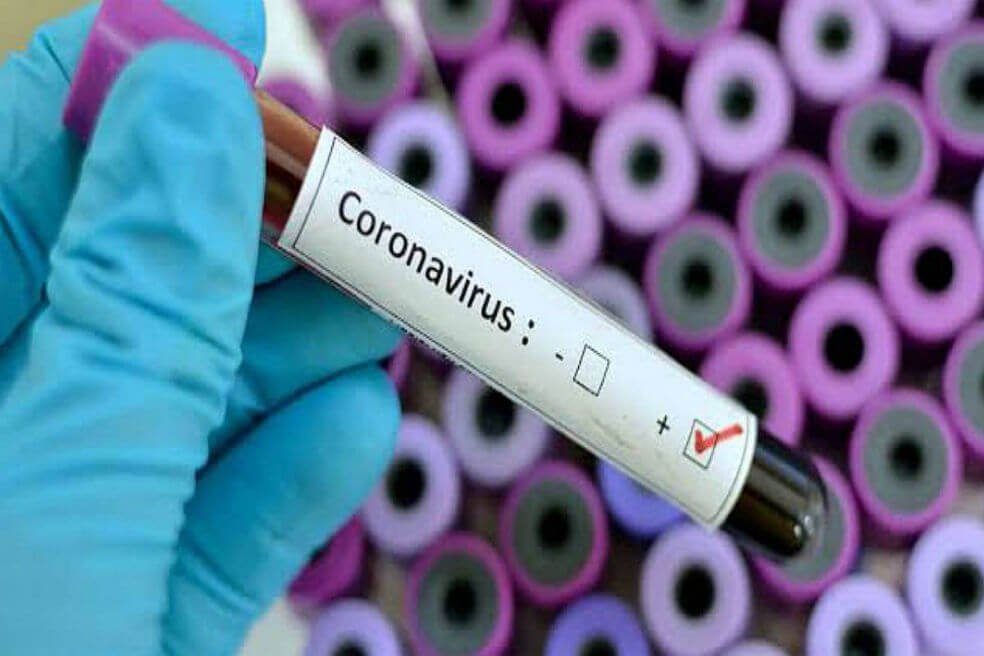 No se han confirmado casos de coronavirus en Villavicencio 1