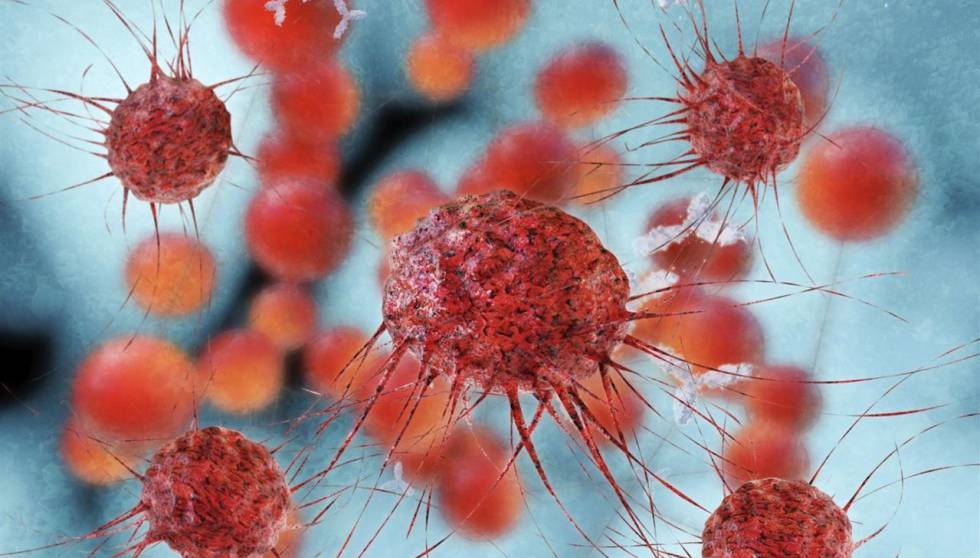 Conozca los 5 cánceres “más raros" 1