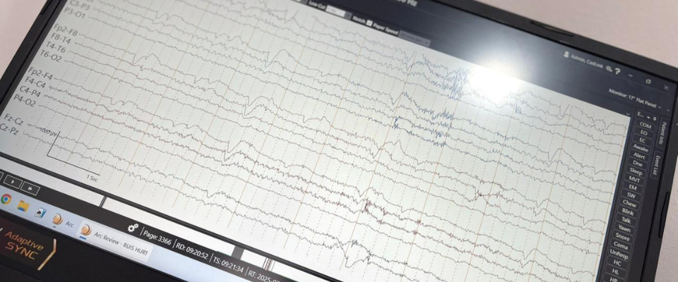 Hospital de Villavicencio incorpora examen especializado para diagnósticos neurológicos 2 Hospital de Villavicencio incorpora examen especializado para diagnósticos neurológicos 2