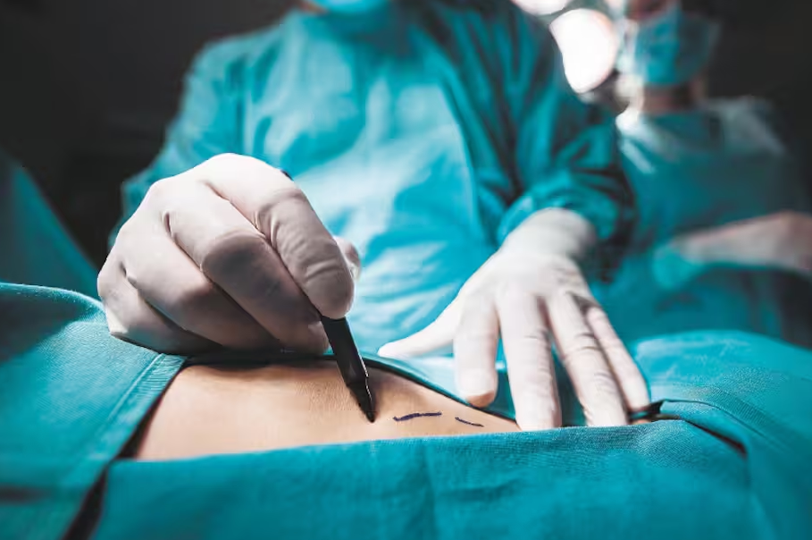 Villavicencio: Secretaría de Salud advierte riesgos de cirugías estéticas en centros no habilitados 2 Villavicencio: Secretaría de Salud advierte riesgos de cirugías estéticas en centros no habilitados 2